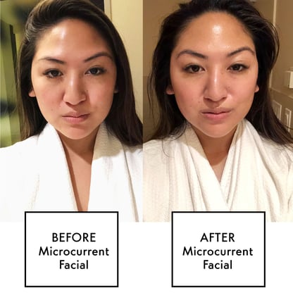 beforeaftermicrocurrent-1559579698
